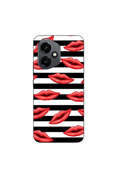 OEM Husa compatibila cu Honor 400 Silicon Gel Tpu Model Striped Kisses