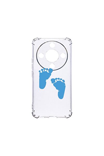 bestcase ¬Æ Husa Anti Shock 1.5MM, Compatibila Cu Honor X9b / Magic6 Lite / X...