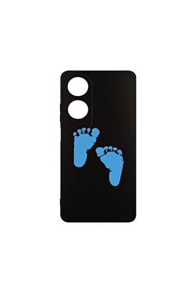 bestcase Λεπτή Θήκη Σιλικόνης 0.8MM, Συμβατή με OPPO A60, Σχέδιο Ποδιών Αγορι...