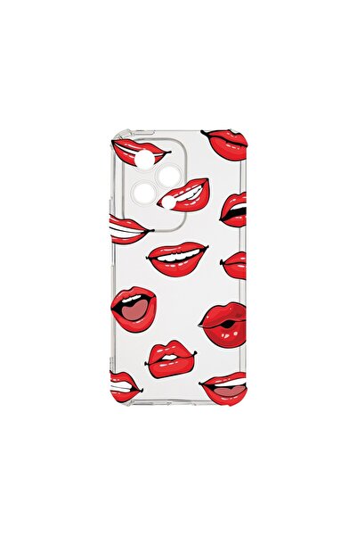 bestcase Θήκη για Honor 200 Lite 5G, BestCase® Αντικραδασμική 1.5MM, Lips - Σ...