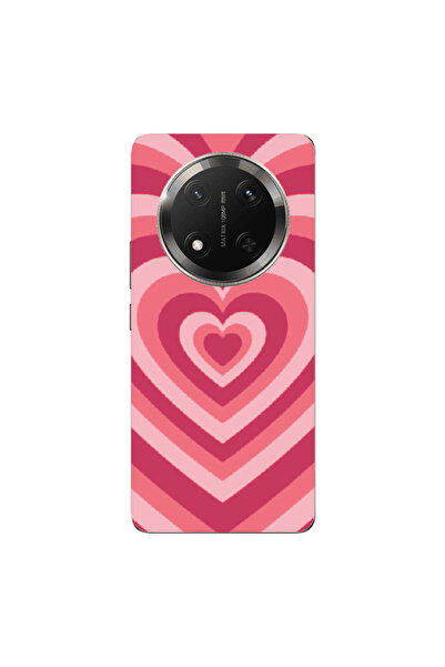 Other Honor Magic 7 Lite Hypnotizing 2 Transparent Silicone TPU Θήκη