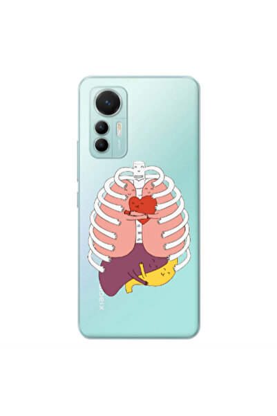Other Xiaomi Mi 12 Lite Anatomy Transparent Silicone TPU Θήκη