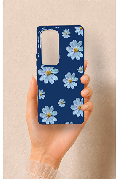 Vip Case Vivo V30 Uyumlu Mavi Papatya Desenli Silikon Kılıf