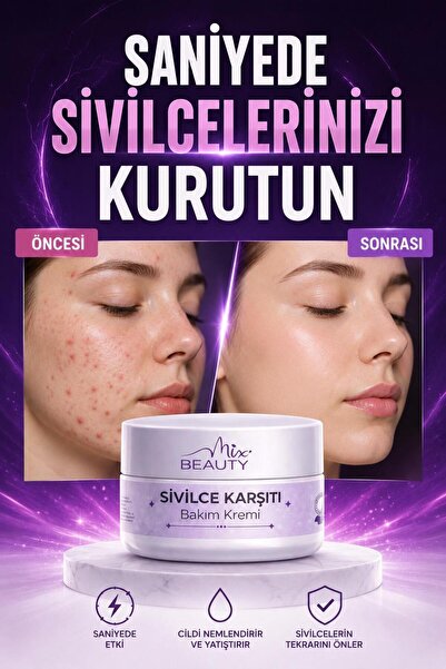 Miya Beauty Sivilcê Karşıtı Önleyici Krem Vitamin İçeren Siyah Nokta Ákne Sîv...