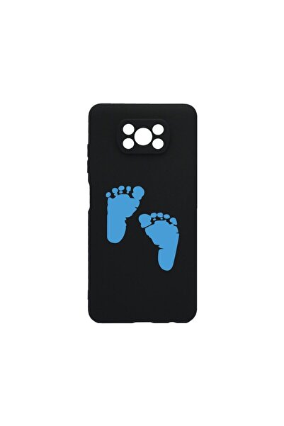 bestcase Λεπτή Θήκη Σιλικόνης 0.8MM, Συμβατή με Xiaomi Poco X3 Pro, Σχέδιο Πο...