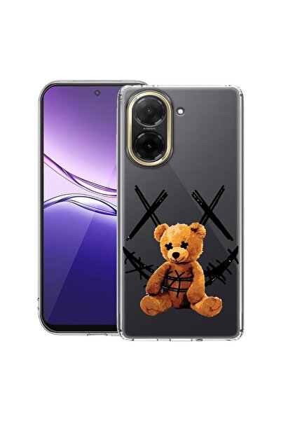 bestcase Διαφανής Λεπτή Θήκη Σιλικόνης Συμβατή με Xiaomi Redmi A5 (171 χιλ.),...