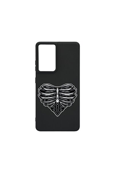 bestcase ¬Æ Husa Slim SIlicon 0.8MM, Compatibila Cu Honor 200 Lite, Skeleton ...