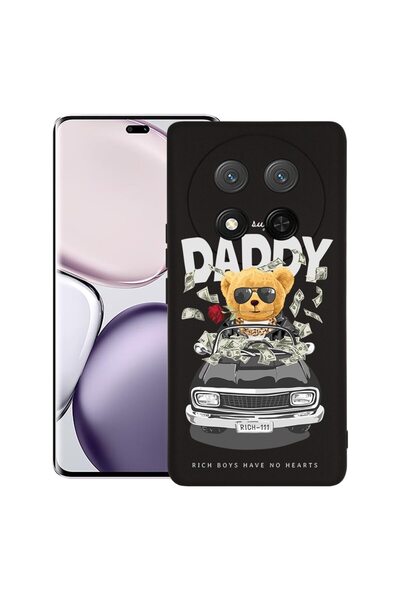 bestcase Θήκη για Honor Magic 7 Lite, Προστατευτική λεπτή θήκη σιλικόνης Prem...
