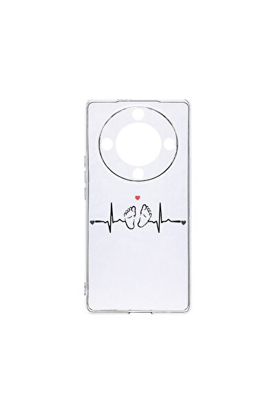 bestcase Θήκη Διαφανής Σιλικόνη 2MM, Συμβατή με Honor Magic6 Lite / X9b / X50...