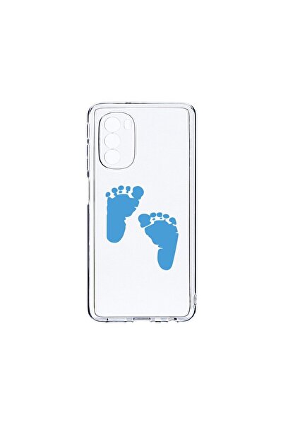 bestcase Husa BestCase¬Æ Clear Silicon 2MM, Compatibila Cu Motorola Moto G51 ...