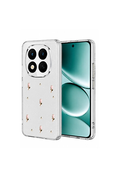 evimdeyokyok Xiaomi Redmi Note 15 Pro Plus 5g Fiyonk Desenli Kapak - Desen 6