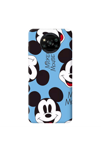 Other Xiaomi Poco X3 /X3 Pro Mickey Mouse Blue Colored Silicone TPU Θήκη