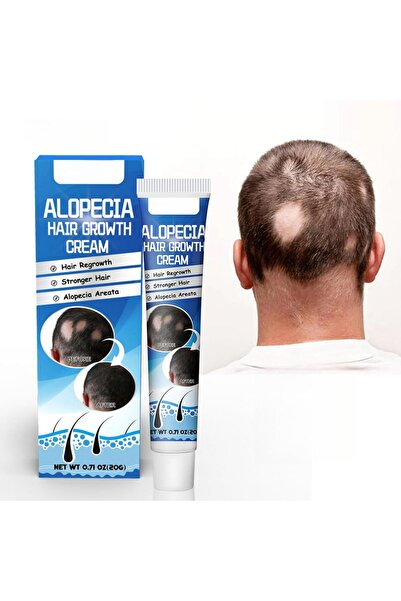 HONPOLO Alopecia Hair Growth Cream, 20g - Revitalizing Scalp and Promoting Ha...