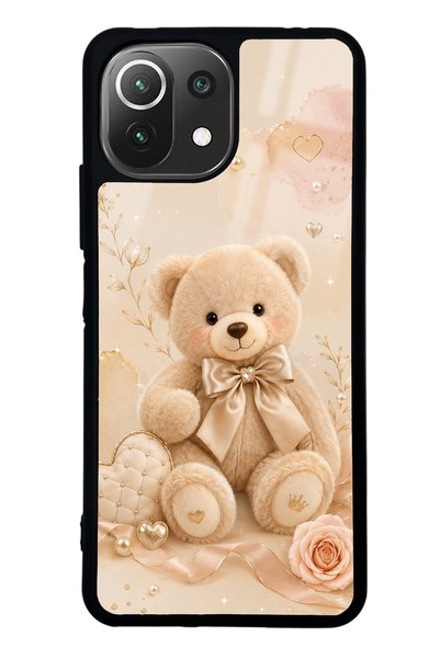 Spoyi حافظة هاتف Xiaomi Mi 11 Lite Pearl Teddy ذات تصميم لامع
