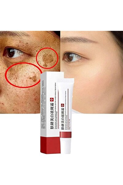 HWA Whitening Freckle Cream, Acne Scar Removal Treatment Cream, Pigmentation ...