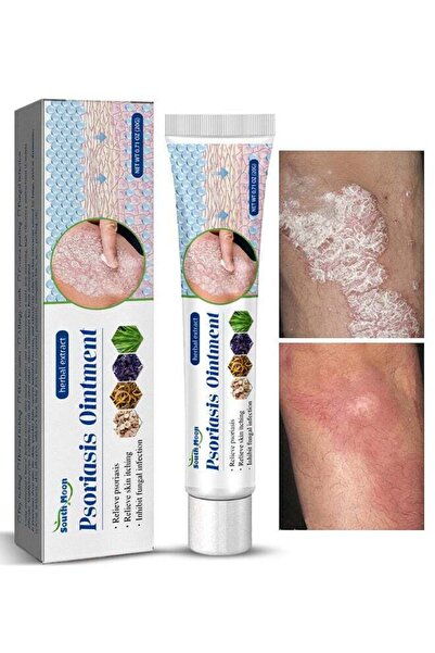 South Moon Herbal Extract Psoriasis Ointment - High Quality Itchy Skin Relief...