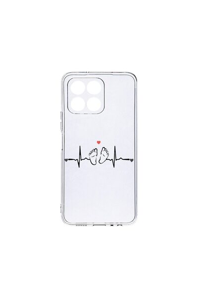 bestcase Husa BestCase¬Æ Διαφανής Σιλικόνη, Συμβατή με Honor 70 Lite, My Litt...