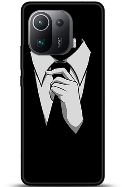 Noprin Xiaomi Mi 11 Pro Case Hd Printed Case - They Can'T Bring Me down 6021