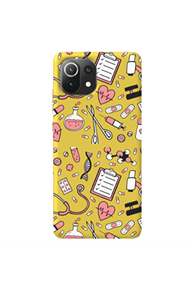 Other Xiaomi Mi 11 Lite Laboratory Yellow Colored Silicone TPU Θήκη