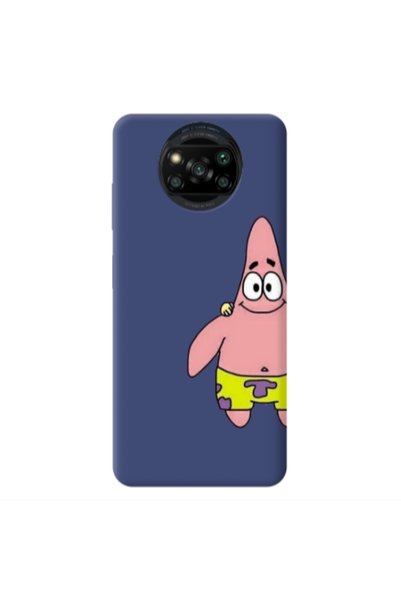 Other Xiaomi Poco X3 /X3 Pro Spong 1 Dark blue Colored Silicone TPU Θήκη