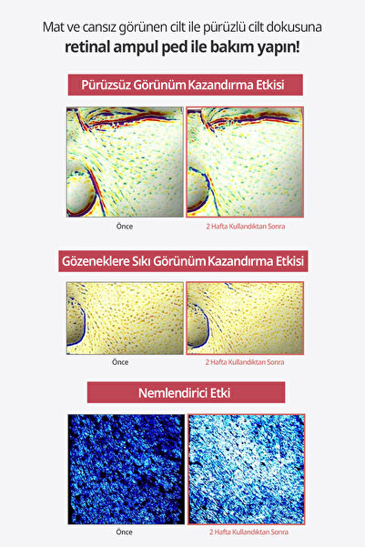 DERMATORY Gözeneklere Sıkı Görünüm Sunan Esnek Yapılı Cilt Bakım Pedi Retinal Lifting Ampoule Pad
