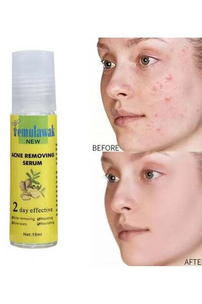 ttemulawak 2 Days Effective Acne Removing Serum Temulawak Acne Treatment