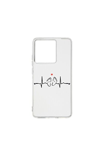 bestcase Θήκη Διαφανής Σιλικόνης 2MM, Συμβατή με Motorola Edge 50 Pro, My Lit...