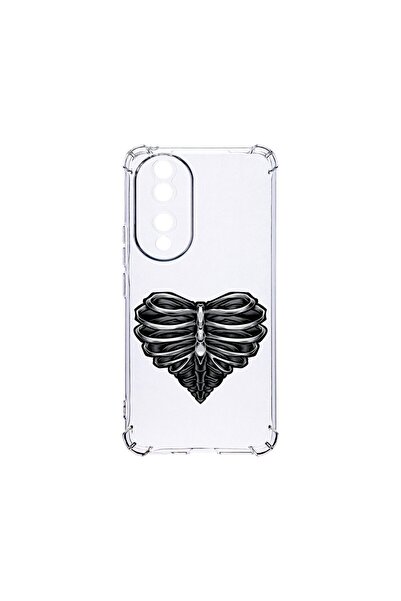 bestcase Husa BestCase¬Æ Anti Shock 1.5MM, Compatibila Cu Honor 90, Skeleton ...