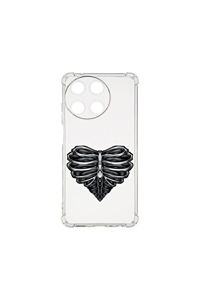bestcase Husa BestCase¬Æ Anti Shock 1.5MM, Compatibila Cu Realme 11 4G, Skele...