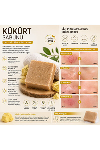 Store Doğal Kükürt Sabunu – Yağlı ve Akneye Eğilimli Ciltler İçin Arındırıcı ...