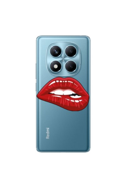 Other Xiaomi Redmi Note 14 Pro Shiny Lips Transparent Silicone TPU Θήκη