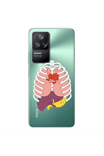 Other Xiaomi Poco F4 Anatomy Transparent Silicone TPU Θήκη