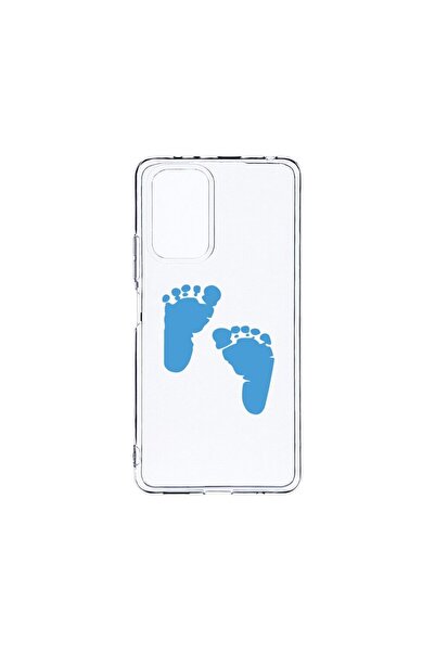 bestcase Прозрачен силиконов калъф 2ММ, съвместим с Xiaomi Redmi Note 10 4G, ...