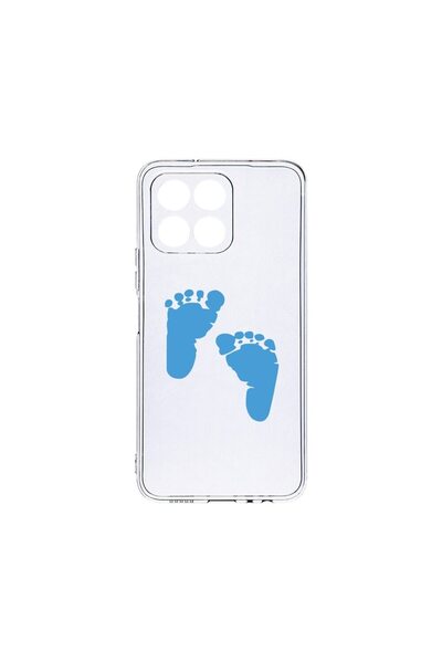 bestcase Husa BestCase¬Æ Clear Silicon, Compatibila Cu Honor X8 5G, Boy Feet ...