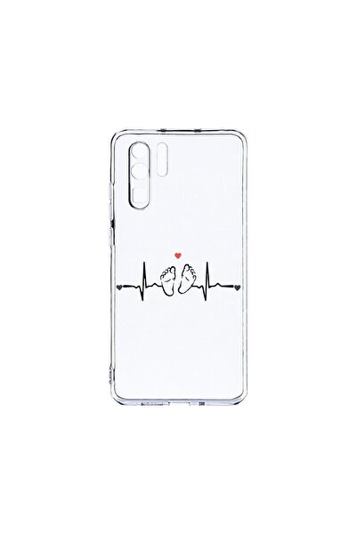 bestcase Husa BestCase¬Æ Clear Silicon 2MM, Compatibila Cu Huawei P30 Pro, My...