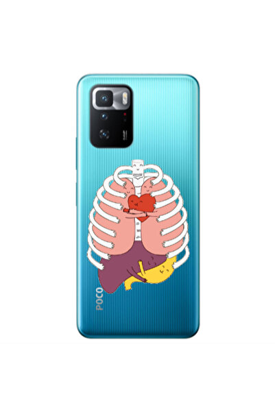 Other Xiaomi Poco X3 GT Anatomy Transparent Silicone TPU Θήκη