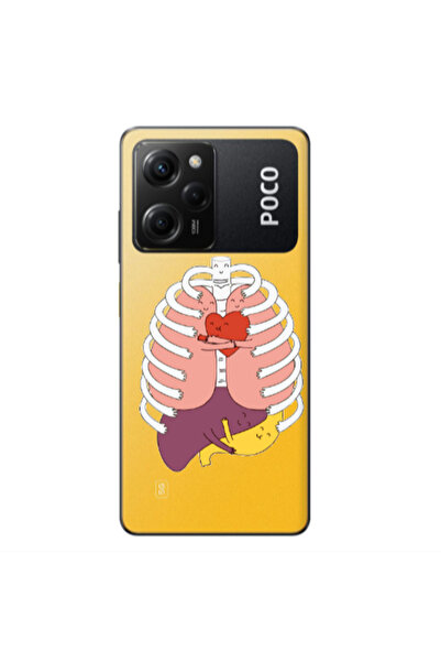 Other Xiaomi Poco X5 Pro Anatomy Transparent Silicone TPU Θήκη