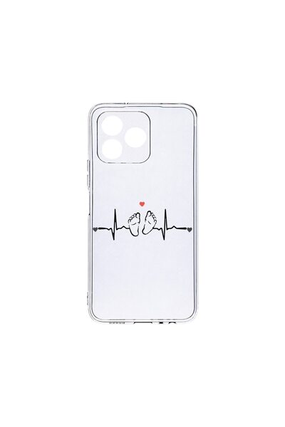 bestcase Husă transparentă din silicon de 2MM, compatibilă cu Xiaomi Redmi 13...