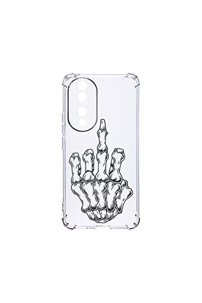 bestcase Αντικραδασμική Θήκη 1.5MM, Συμβατή με Honor 90, Σχέδιο Σκελετωμένου ...