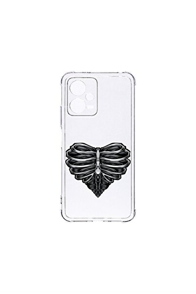 bestcase Husa BestCase¬Æ Anti Shock 1.5MM, Compatibila Cu Poco X5 / Xiaomi Re...