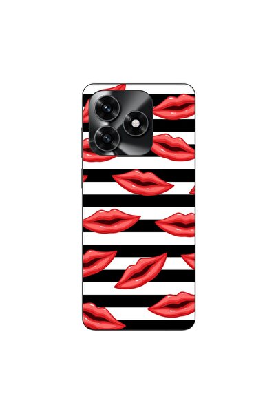 OEM Husa compatibila cu Honor X5c Plus Silicon Gel Tpu Model Striped Kisses