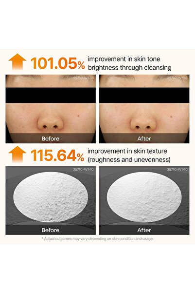 Dr.Melaxin Dr. Melaxin Peel Shot Kojic Acid Turmeric Serum – Exfoliating Dark Spot Corrector with AHA/BHA & Niacinamide, Brightening & Even Tone Facial Serum (80ml / 2.70 fl oz)