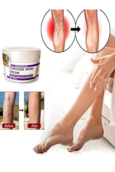 Generic Brand West & Month Varicose Vein Anti-Varis Massage Care Cream 100 ml