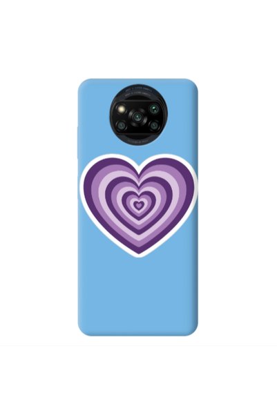 Other Xiaomi Poco X3 /X3 Pro My Heart Is Yours 2 Blue Colored Silicone TPU Θήκη