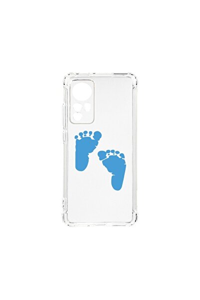 bestcase Αντικραδασμική Θήκη 1.5MM, Συμβατή με Xiaomi 12 Pro, Σχέδιο Ποδιών Α...