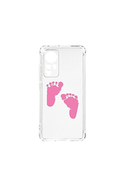bestcase Husa BestCase¬Æ Anti Shock 1.5MM, Compatibila Cu Xiaomi 12 Pro, Girl...
