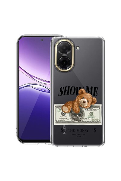 bestcase ¬Æ Husa Clear Slim Silicon Compatibila cu Xiaomi Redmi A5 ( 171 mm )...