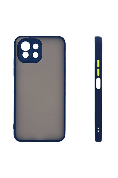 Sonique Θήκη Σιλικόνης Color Button Bumper Xiaomi Mi 11 Lite 4G / Mi 11 Lite ...