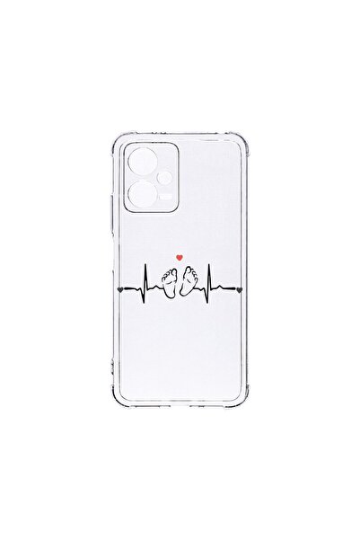 bestcase Husa BestCase¬Æ Anti Shock 1.5MM, Compatibila Cu Poco X5 / Xiaomi Re...