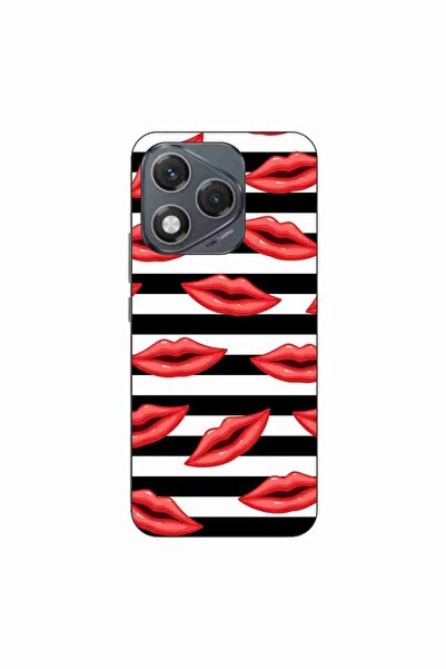 OEM Husa compatibila cu Honor 400 Lite Silicon Gel Tpu Model Striped Kisses